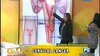 Understanding Cervical Cancer [upl. by Past]