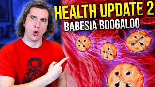 Health Update 2 Babesia Boogaloo [upl. by Job102]