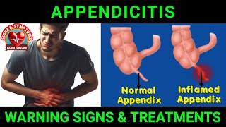 Appendicitis Symptoms and Treatment Options appendicitis [upl. by Eidarb304]