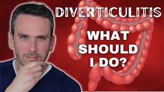 What to do AFTER DIVERTICULITIS [upl. by Evetta]