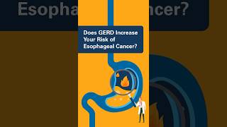 Does GERD Increase Your Risk of Esophageal Cancer [upl. by Whall390]