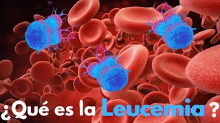 ¿Qué es la Leucemia [upl. by Aklam]