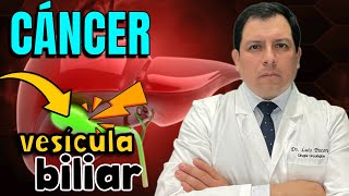 CUIDADO ⚠️ ¿PIEDRAS EN LA VESÍCULA ¿RIESGO DE CÁNCER [upl. by Oicinoid]