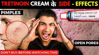 How to Apply Tretinoin Cream I Tretinoin Journey I Tretinoin Side Effects [upl. by Clarkin]