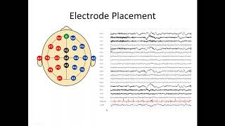 Understanding the EEG [upl. by Ansev]