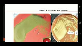 Apurba S Sastry Microbiology Bacterial Lobar Pneumonia Part 1 [upl. by Atinal]