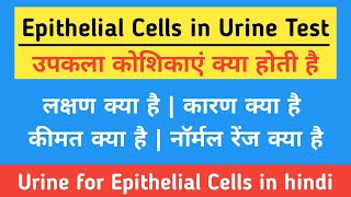 Epithelial Cells in Urine in hindi  Causes Symptoms Price amp Normal Range  उपकला कोशिकाएं क्या है [upl. by Lief]