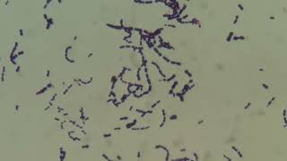 Gram positive bacteria Gemella in Gram Staining [upl. by Cthrine]