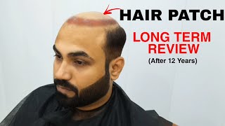 Hair Patch Long Term Review Client using hair patch for the past 12 years shares his experience [upl. by Artemla]