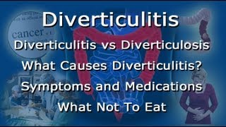 Diverticulitis Vs Diverticulosis  What To Eat What Not To Eat With Diverticulitis [upl. by Ecirtael153]