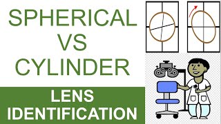 Spherical Vs Cylindrical Lens I Lens Identification I Step 1 [upl. by Lahsram]