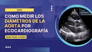 🤓Como medir los 🎯DIÁMETROS DE LA AORTA por ECOCARDIOGRAFÍA Guía paso a apaso [upl. by Caryn]