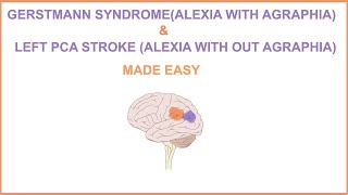 GERSTMANN SYNDROMEALEXIA WITH AGRAPHIA amp LEFT PCA STROKEALEXIA WITHOUT AGRAPHIA MADE EASY [upl. by Eirak813]