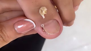 ITS ALWAYS ITCHING Nailart Salonnails Pedicure Nailcaretips Nailtrends nails [upl. by Eelasor]