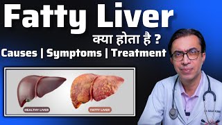 Fatty Liver Causes Symptoms and Treatment  क्या होता है फैटी लिवर और इसका इलाज कैसे किया जाता है [upl. by Raina]