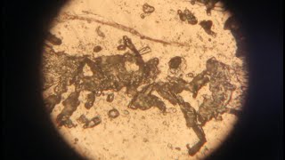 Metallographic microscope observation of intergranular corrosion test of gold phase [upl. by Jezrdna170]