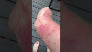 Repel insect repellent buyer aware nontoxicliving productreview skincare insectrepellent [upl. by Hoo788]