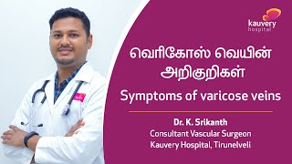 Symptoms amp Complications of Varicose Veins  Tamil [upl. by Leksehc]