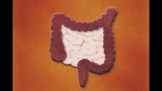 Patología Isquémica Intestinal Definición Evaluación Tratamiento [upl. by Pinkerton159]