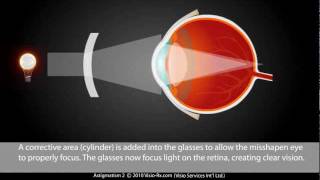 Astigmatism explained Easily Corrected With A Cylinder in Your Eyewear Glasses [upl. by Frost773]