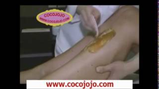 Sugaring Hair Removal  Different techniques to Do Sugaring Hair Removal [upl. by Nolla370]