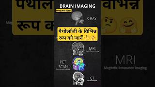 पैथोलॉजी के विभिन्न रूपneetbiology gktricks शॉर्ट्स shorts viral youtube sscuptet [upl. by Irotal]