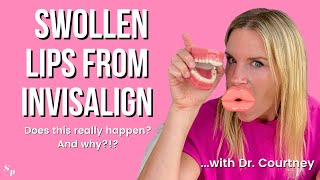 CAN YOU GET SWOLLEN LIPS FROM INVISALIGN 2024  Its rare but it can happen Learn 3 reasons why [upl. by Hippel]