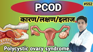 POCD problem solution in hindi  PCOD treatment in hindi  PCOD kya hota hai [upl. by Macdermot]