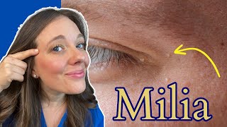 How to Get Rid of Milia  Tiny White Bumps [upl. by Rolan]