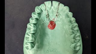 Finger Spring Fabrication  Removable Orthodontic Appliance  Orthodontics [upl. by Pasquale739]