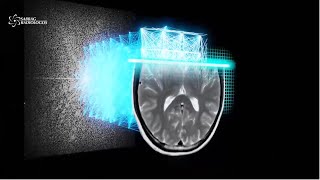 Inteligencia Artificial en Resonancia Magnética [upl. by Lynnett]