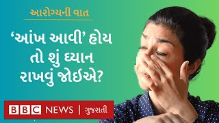 Conjunctivitis  આંખના આ રોગથી બચવા માટે શું કરવું જોઈએ Health Explainer [upl. by Hatch]