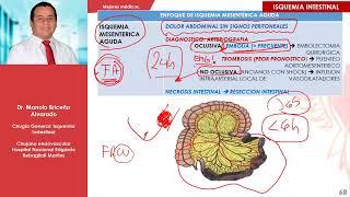 APOYO TEÓRICO Nº5  Isquemia Intestinal [upl. by Mihalco]