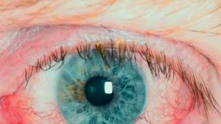 Home remedies for Itchy Eye  Red Eye amp Eye Redness [upl. by Hera624]