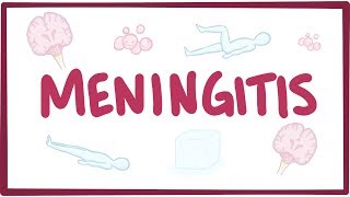 Meningitis  causes symptoms diagnosis treatment pathology [upl. by Yasdnyl]