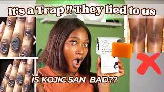 WHY KOJIC SAN SOAP IS NOT WORKING FOR YOU  HOW TO SPOT THE FAKE  Do’s amp Don’t [upl. by Sweeney]