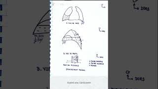 Épanchement pleural et ponction pleurale [upl. by Anayra]