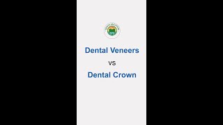 Front Teeth Crowns vs Veneers Simplified [upl. by Annahsed]