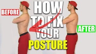 How To Fix Your Posture  ANTERIOR PELVIC TILT [upl. by Butler48]