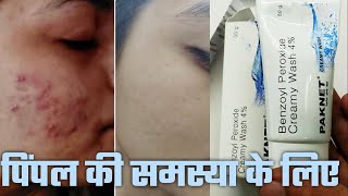 Paknet cream wash uses in hindi benefits PAKNET Benzoyl Peroxide Face Wash pimple acne Paknet [upl. by Nol]