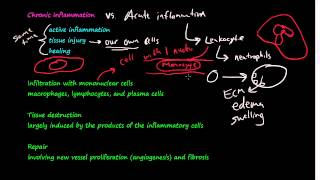 28  Chronic Inflammation  Introduction Macrophages [upl. by Eenttirb]