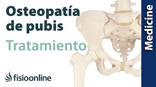 Cómo tratar la Osteopatía de pubis Quirúrgico y conservador [upl. by Atirb]