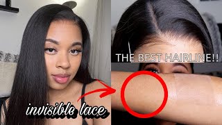 How Beginners Can Melt Lace Like A Pro The Best New Clear Scalp Lace Wig ft XrsBeauty Hair [upl. by Tristan623]