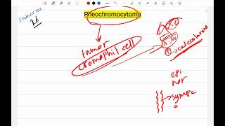 Pheochromocytoma [upl. by Ailatan]