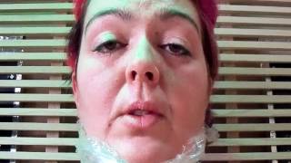 Healing Leukemia 9  What I Do For Swollen Lymph Nodes in Neck Head Jaw [upl. by Odicalp]