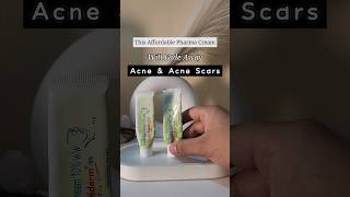 Banish Acne Scars with this✨️ shorts acne acneprone skincare [upl. by Greiner]