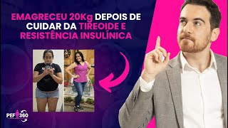 Ela EMAGRECEU 20Kg com 45 anos depois de tratar problemas na TIREOIDE e RESISTÊNCIA INSULÍNICA [upl. by Suvart]