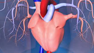 Implantable CardioverterDefibrillator ICD [upl. by Eba36]