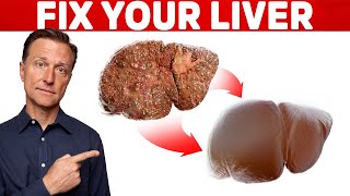 The 6 Best Ways to Heal a Fatty Liver [upl. by Koby]