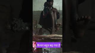 कैन्सर बहुत बढ गया है🙏🙏 video virl Short 💯💯 [upl. by Emilie]